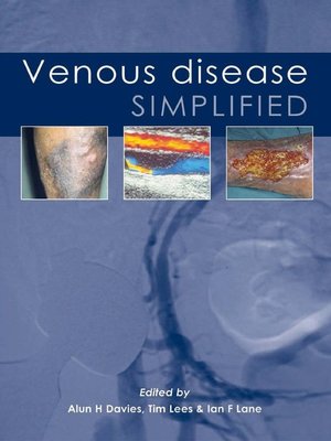 cover image of Venous Disease Simplified